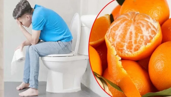 কোষ্ঠকাঠিন্য কমাতে ম্যাজিকের মতো কাজ করে কমলা কোষ্ঠকাঠিন্য কমাতে ম্যাজিকের মতো কাজ করে কমলা