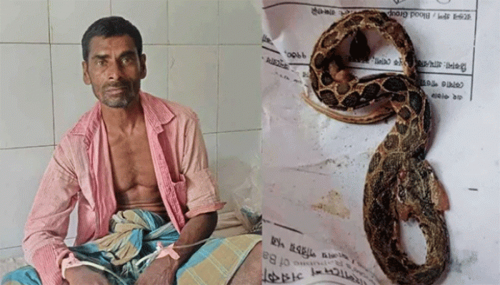কামড় দেওয়া রাসেলস ভাইপার নিয়ে হাসপাতালে কৃষক কামড় দেওয়া রাসেলস ভাইপার নিয়ে হাসপাতালে কৃষক