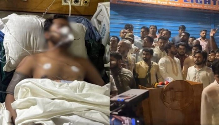 নুরের জ্ঞান ফিরেছে, শারীরিক অবস্থা নিয়ে যা জানা গেল নুরের জ্ঞান ফিরেছে, শারীরিক অবস্থা নিয়ে যা জানা গেল