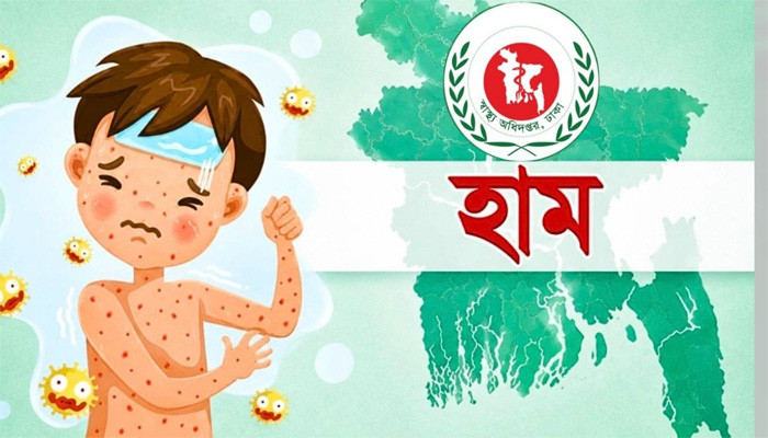 দেশে হাম উপসর্গে আরো ৪ শিশুর মৃত্যু